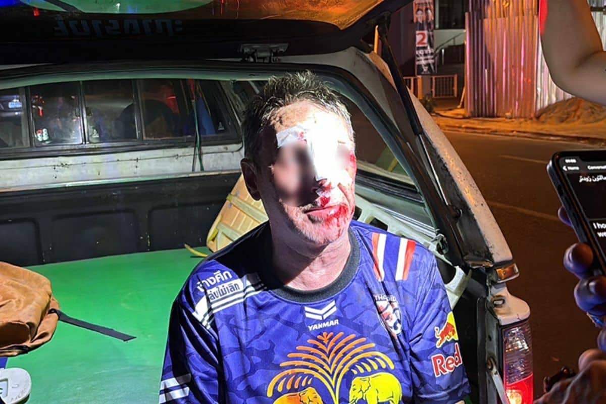 Icelandic man gets his face busted after falling into Pattaya drain