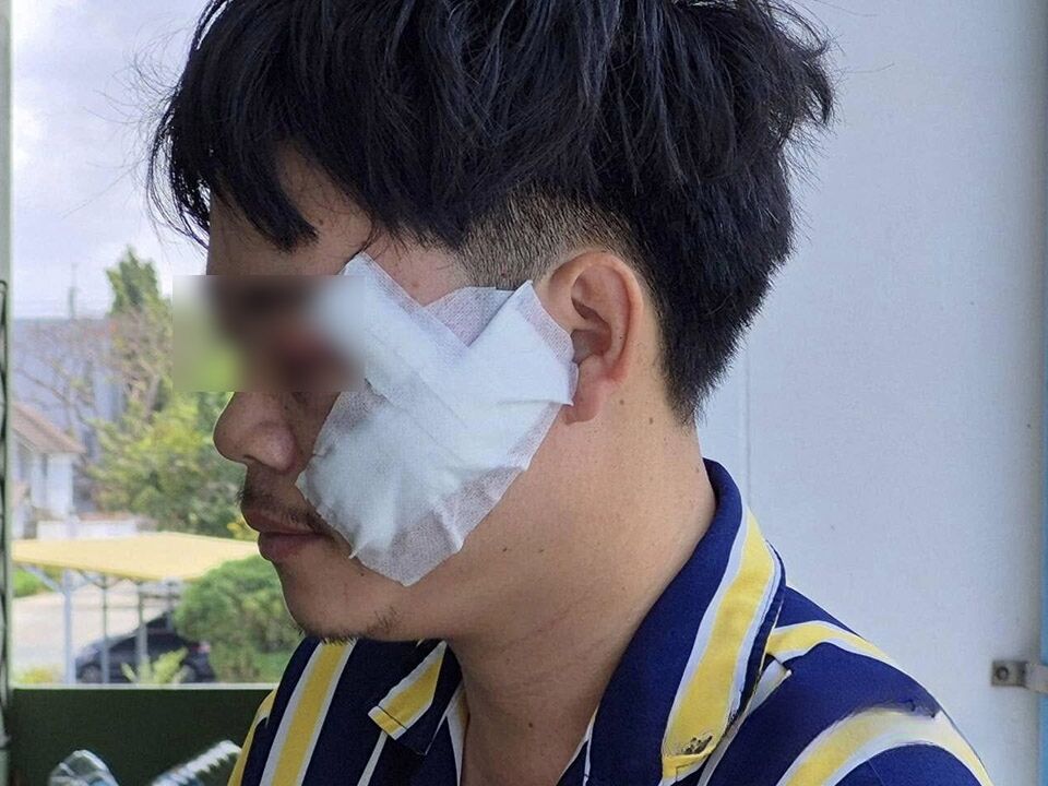 Pattaya road rage: Motorcycle taxi fight ends in stabbing | News by Thaiger