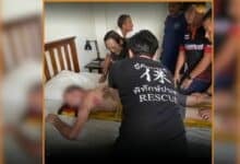 Dutch tourist runs naked in Krabi hotel, takes a tumble