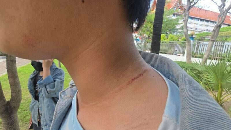 Bar worker beaten outside Patong hotspot after jealous row | News by Thaiger