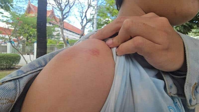 Bar worker beaten outside Patong hotspot after jealous row | News by Thaiger