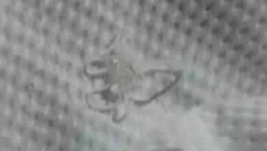 Barking mad! Thai woman finds dog heartworm wriggling inside her