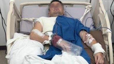 British foodie floored in Phuket road horror crash leaves hospital