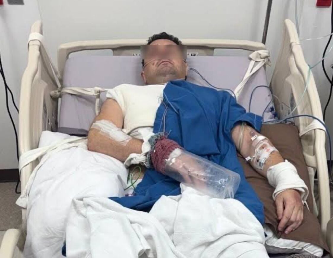 British foodie floored in Phuket road horror crash leaves hospital