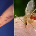 Deadly tropical sandfly behind fatal fever cases in Thailand