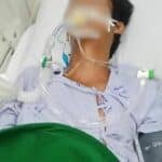 Thai teen in coma after hospital allegedly dismisses snake bite as unimportant