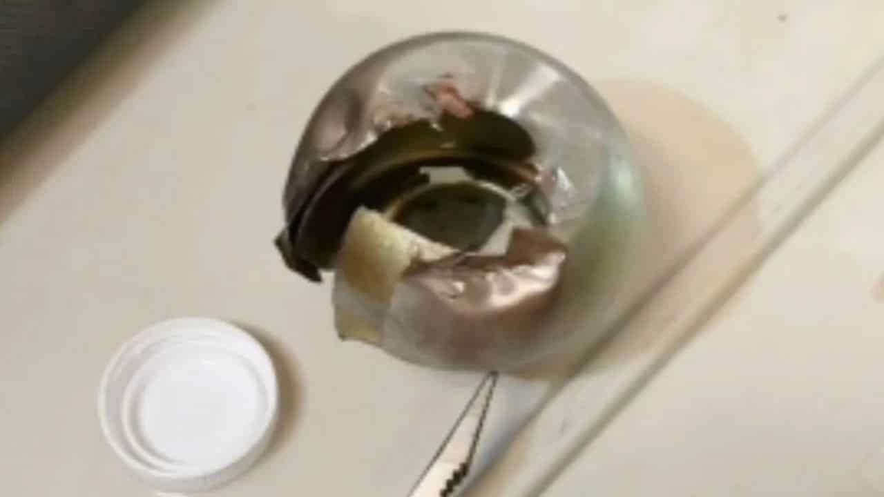 Thai girl's finger stuck in broken doorknob
