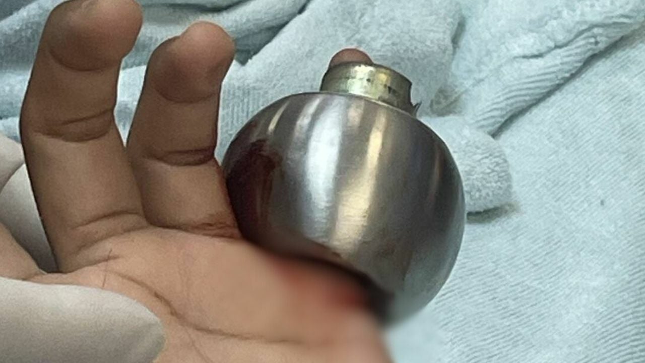 Thai girl's finger trapped in doorknob
