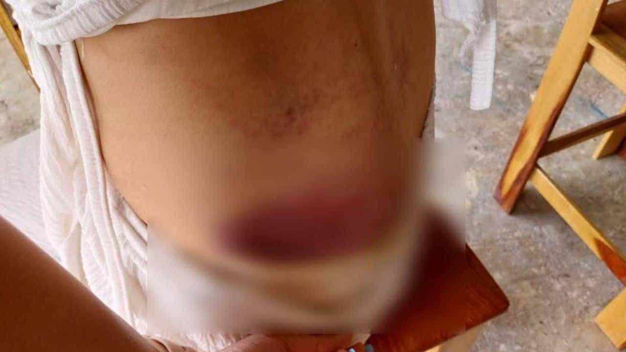 Thai boyfriend assautls girlfriend