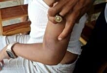 Thai woman jumps from second floor after brutal boyfriend abuse
