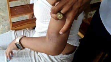 Thai woman jumps from second floor after brutal boyfriend abuse