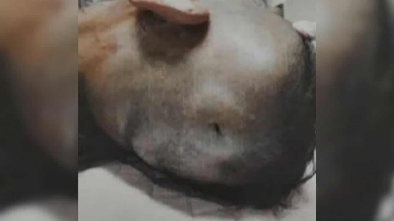 Mentally ill prisoner hit guards with baton