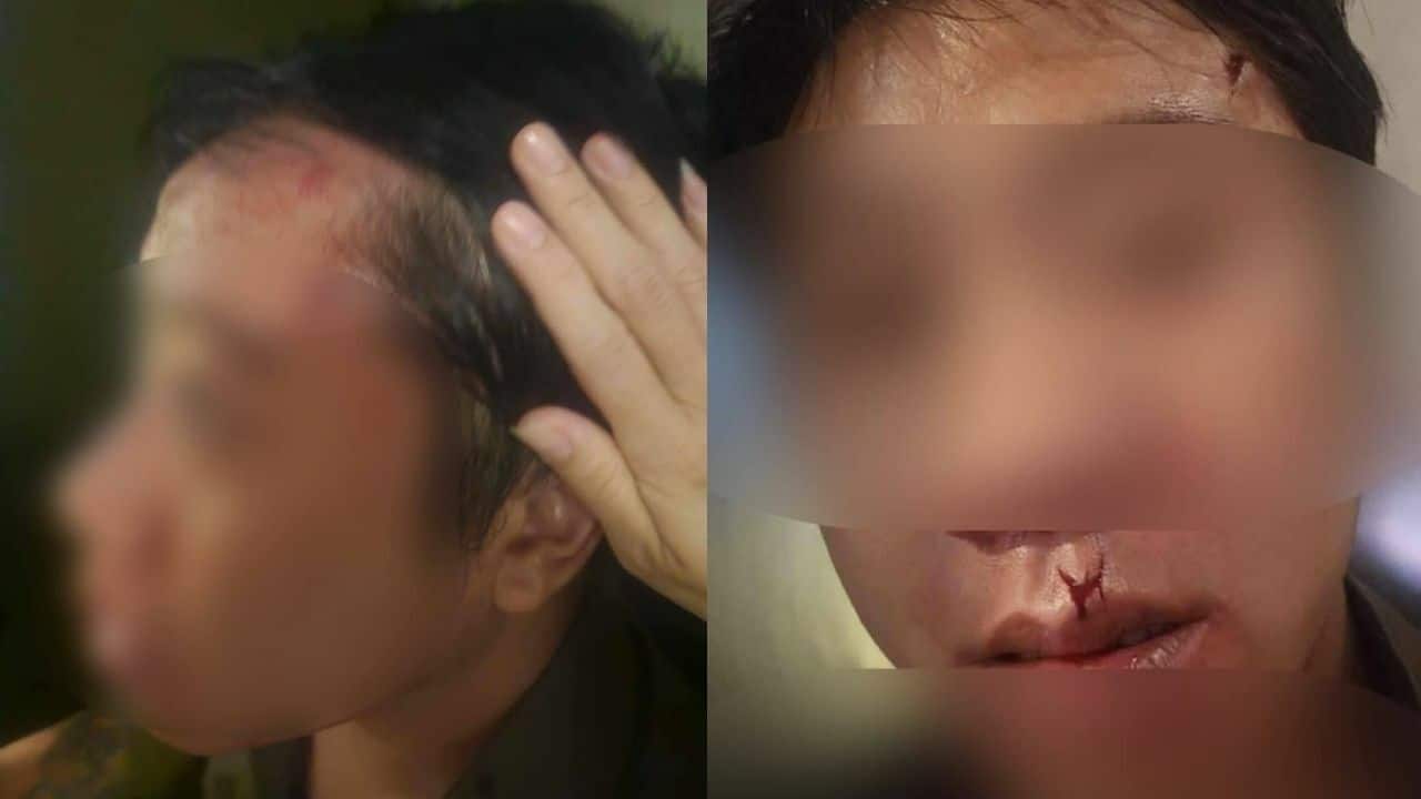 Lampang singer attacked for unfavourite goodbye message