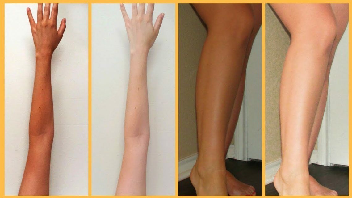 Examples of skin lightening | Photo taken from Almurshidi Medical Tourism website beauty standards