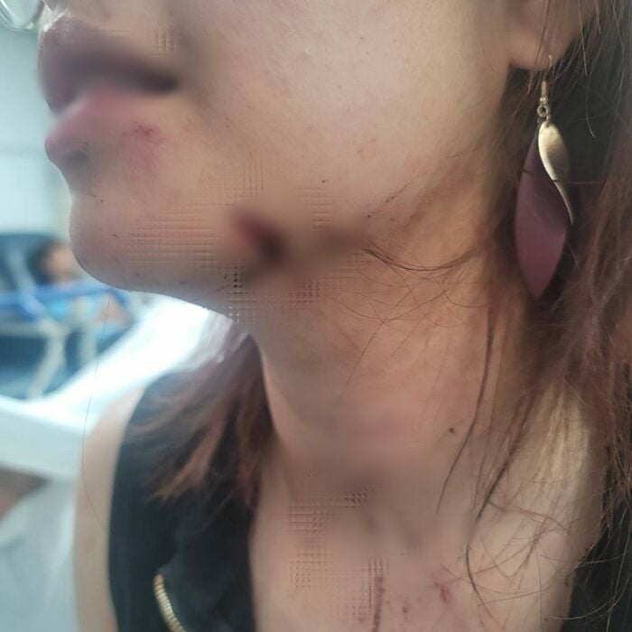 Thai student attacked in New York, transport staff criticised | News by Thaiger