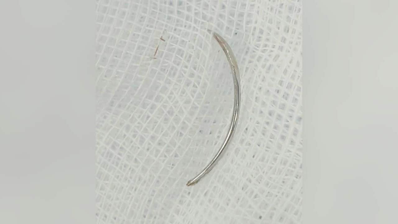 Thai woman found needle in gum