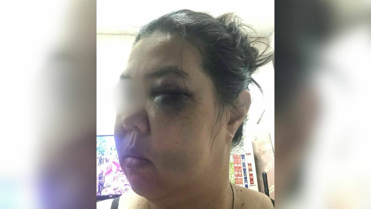 Thai woman and her cat brutally attacked by neighbour couple