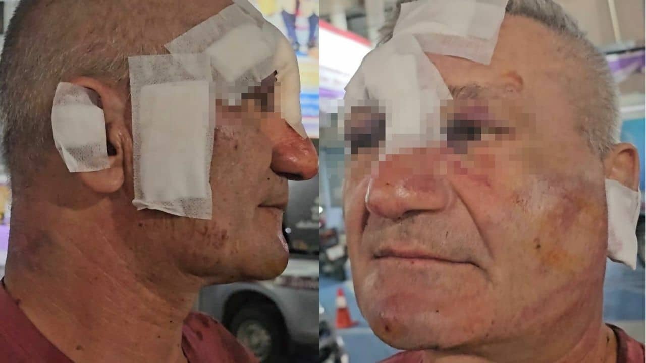Russian attacked and robbed in Pattaya