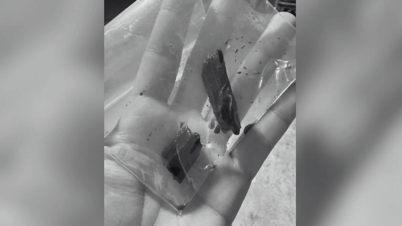 Wood found in wound despite 3 months of treatment in Nakhon Sawan hospital