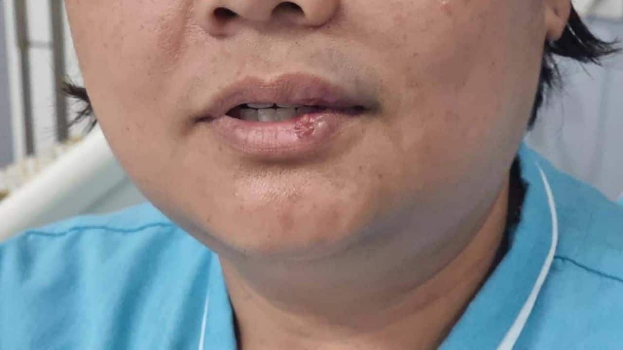 Thai man punches nurse in Nonthaburi