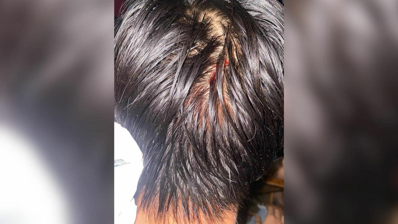 attackers attacked innocent man at restuarant in Bangkok