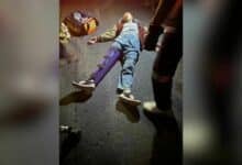 Lop Buri road crash leaves woman with broken leg