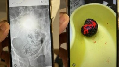 Austrian man hospitalised in Bangkok with 255 meth pills