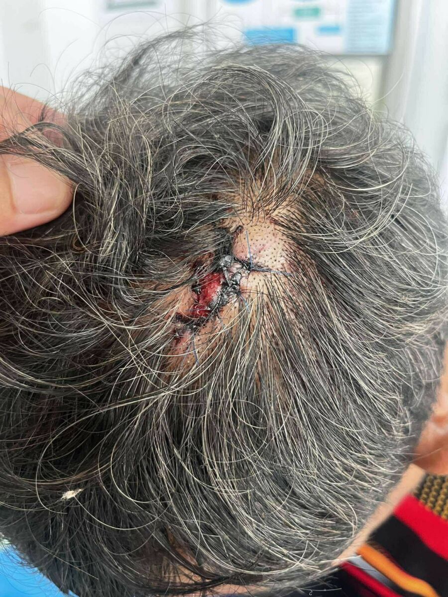 Surat Thani train station horror: Guards beat man over nap | News by Thaiger