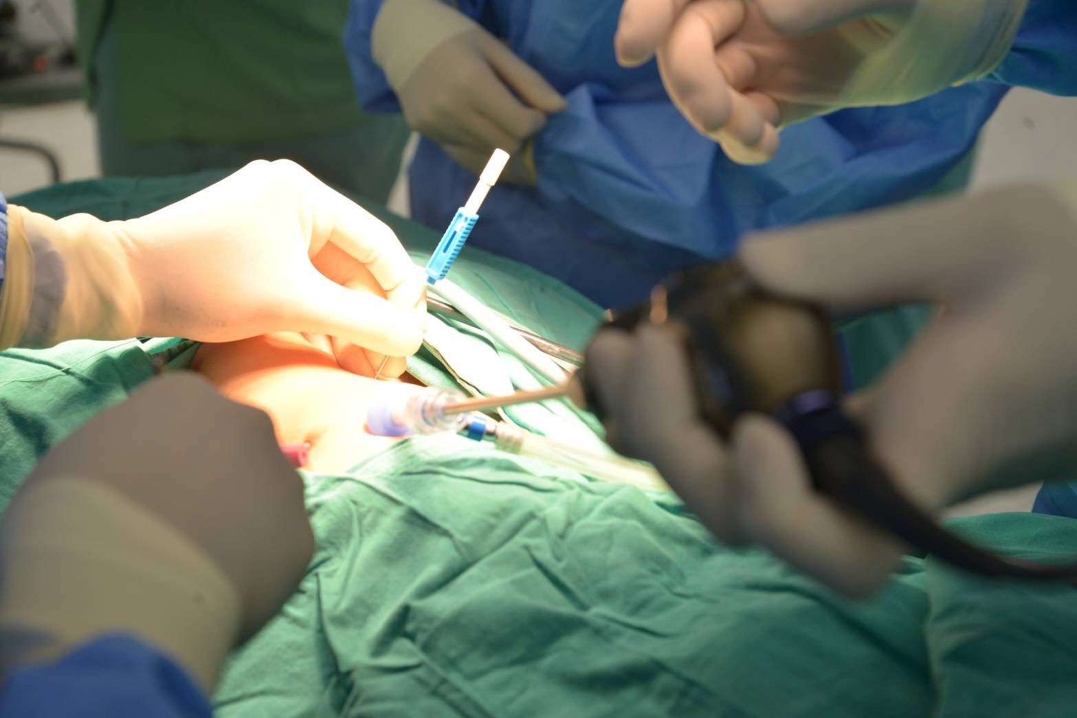 Bangkok doctors perform scar-free baby ops | News by Thaiger