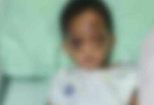 Mother seeks justice after toddler injured under friend’s care