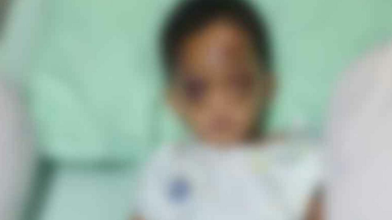 Mother seeks justice after toddler injured under friend’s care