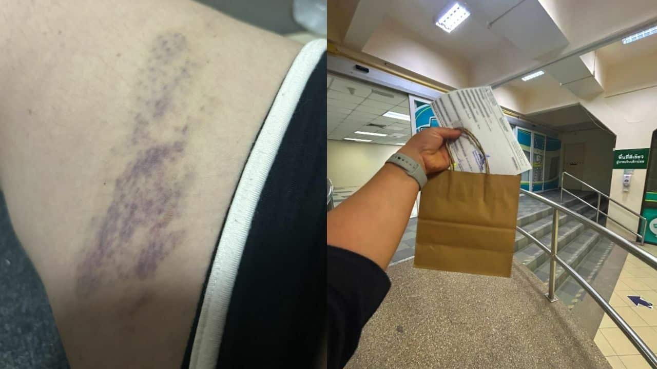 Thai woman escaped car crash with minor injuries