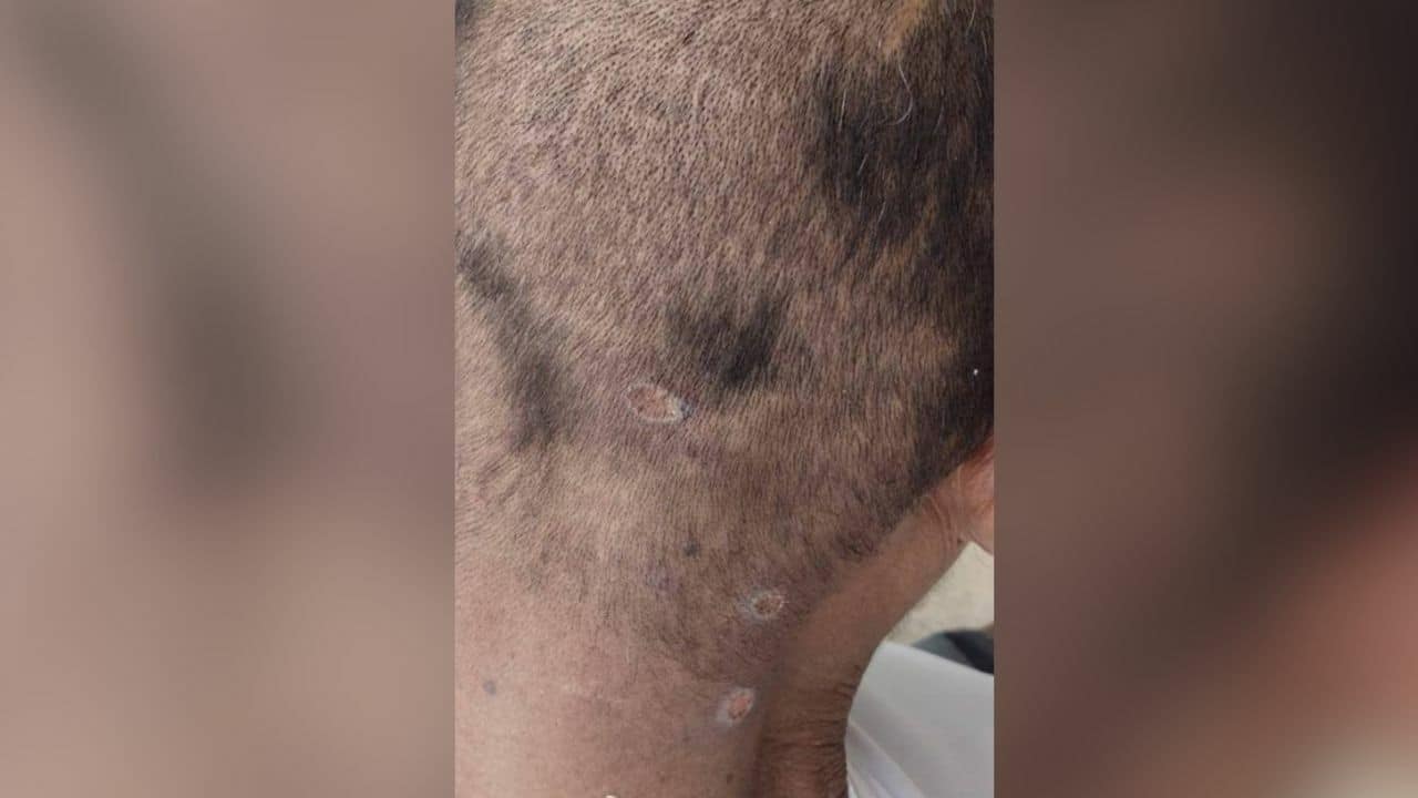 Thai man claims worms habitat in his body after forest visist