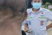 Chiang Rai man claims worms emerge from skin after forest visit