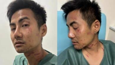 Thai tourist attacked and robbed in Paris, 10,000 baht and documents stolen