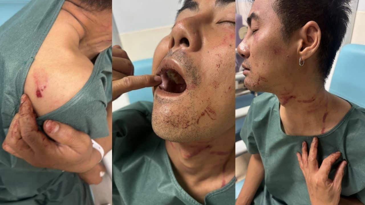 Thai tourist attacked and robbed in Paris