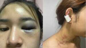 Thai transwoman brutally assaulted and raped by obsessed attacker