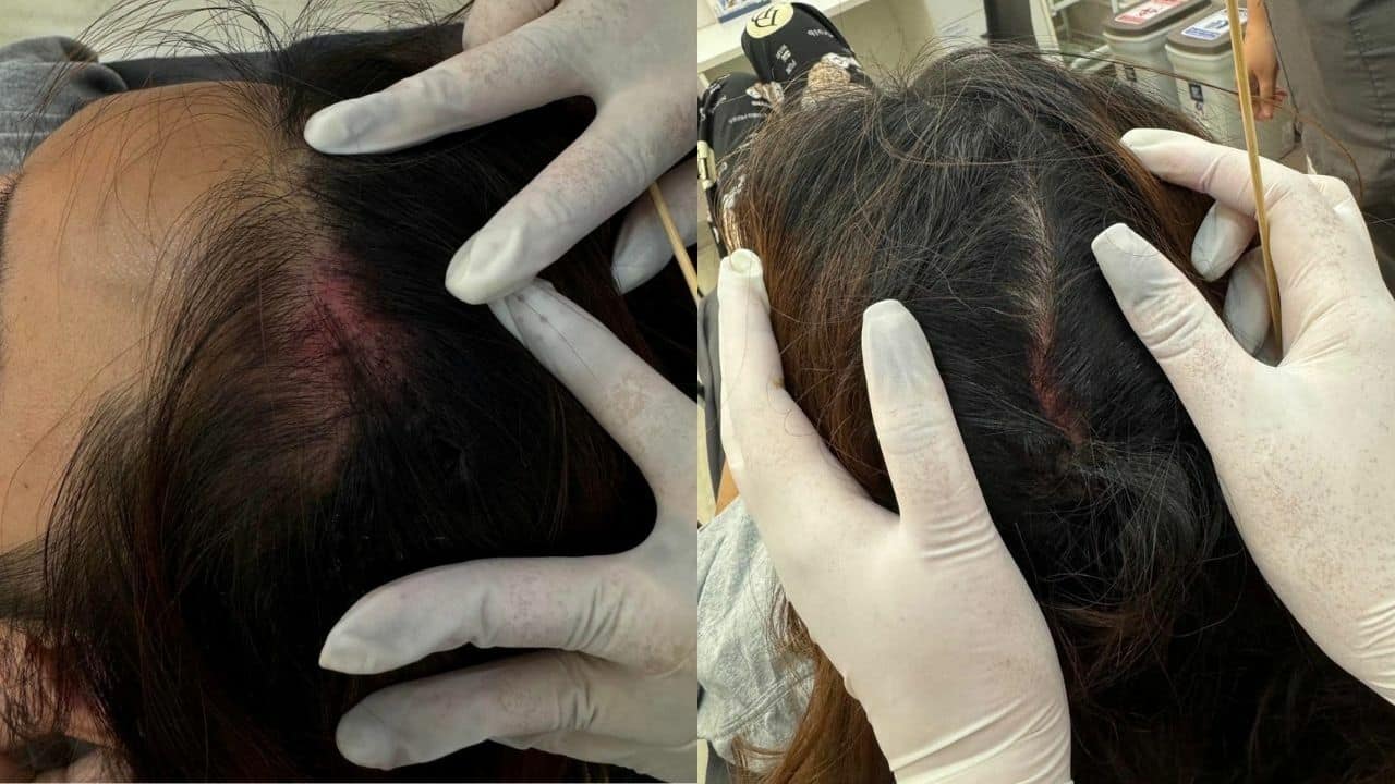 Thai transwoman abused by man she previously had one-night stand with