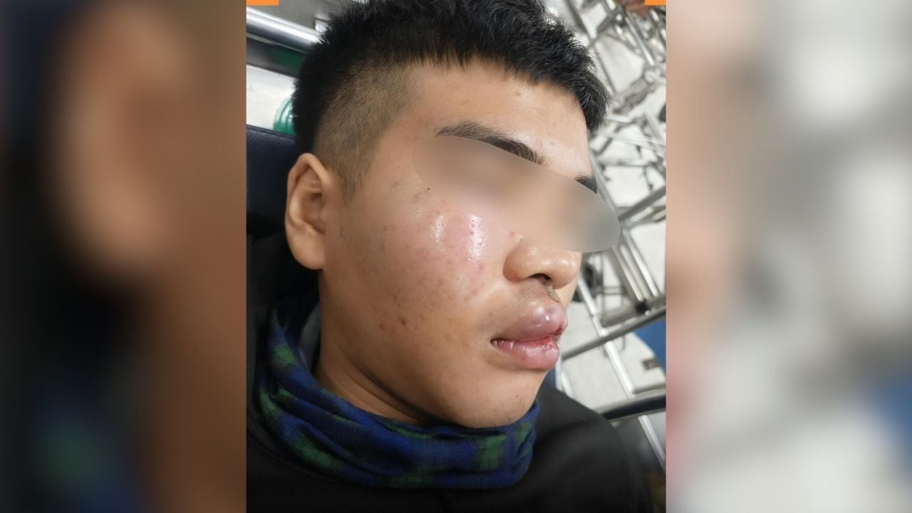Turning sign leads to attack on Thai man