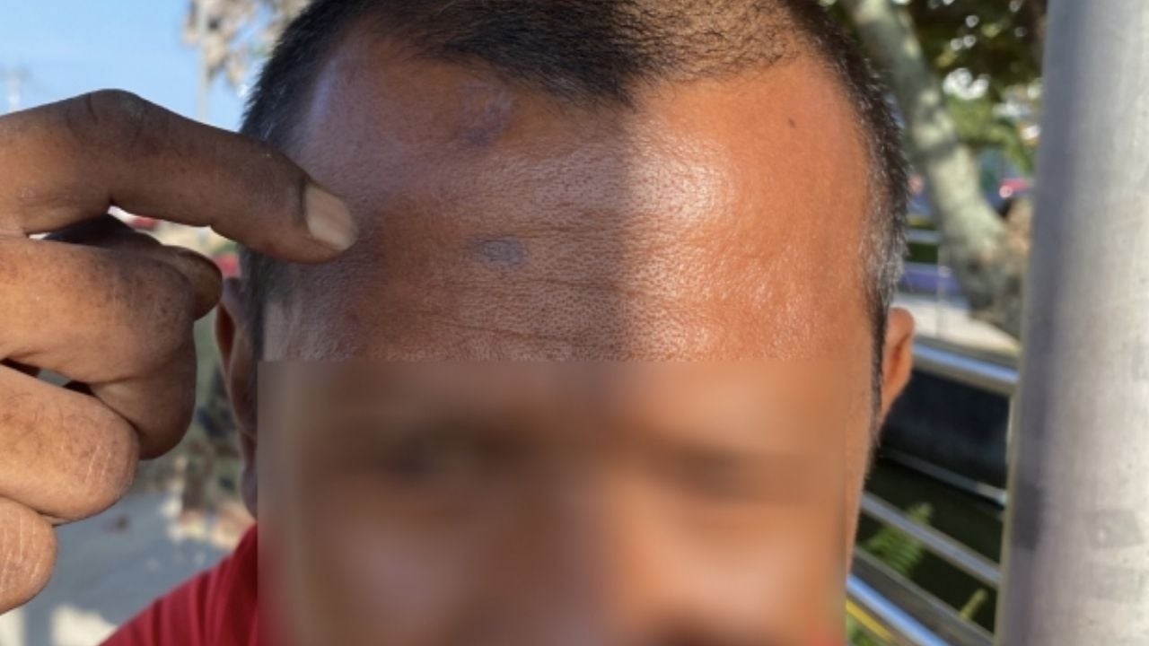 Thai delivery worker attacked by male client