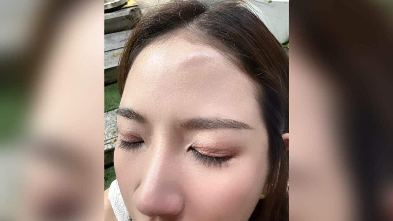 South Korean bar host leads to fight between women and transwomen