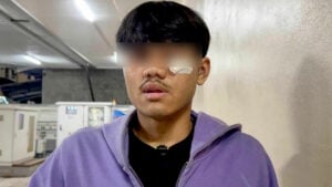 Pattaya teen savagely battered by machete-wielding gang