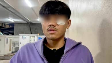 Pattaya teen savagely battered by machete-wielding gang