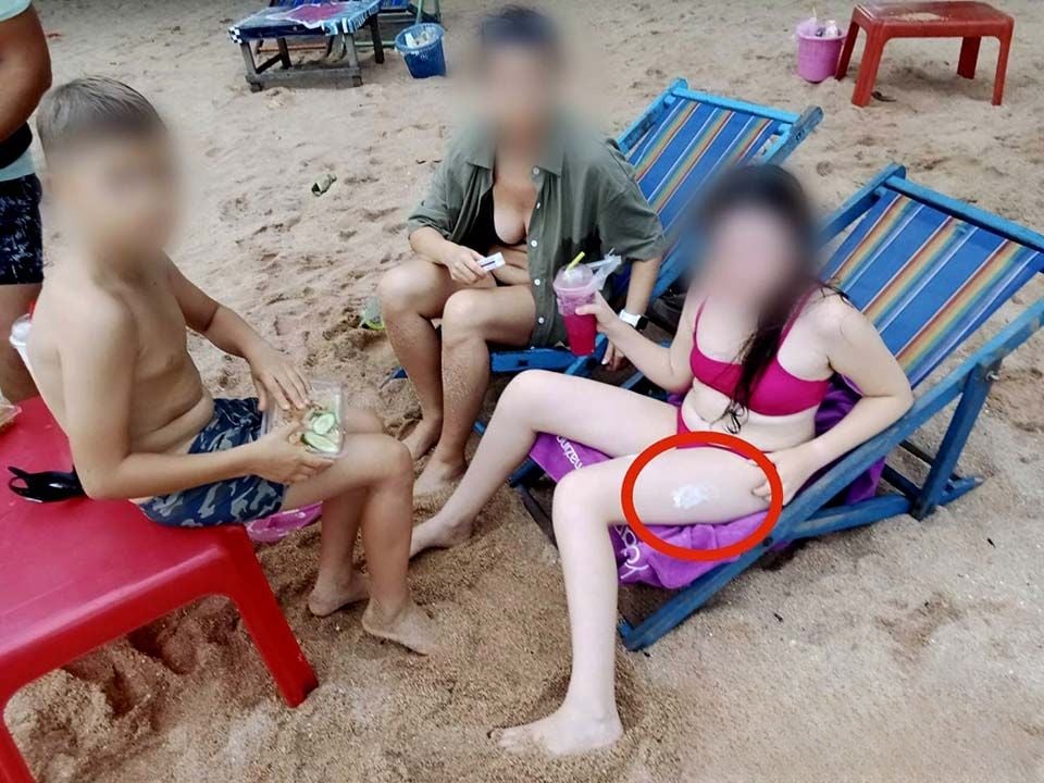 Spiked: Russian girl jabbed by porcupinefish at Jomtien Beach | News by Thaiger