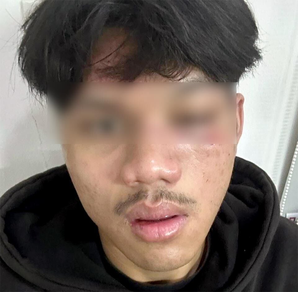 Pattaya teen savagely battered by machete-wielding gang | News by Thaiger