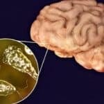 Chiang Mai University warns of deadly brain-eating disease | Thaiger