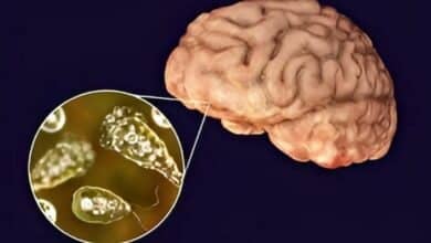 Chiang Mai University warns of deadly brain-eating disease
