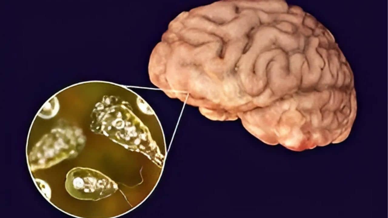 Chiang Mai University warns of deadly brain-eating disease