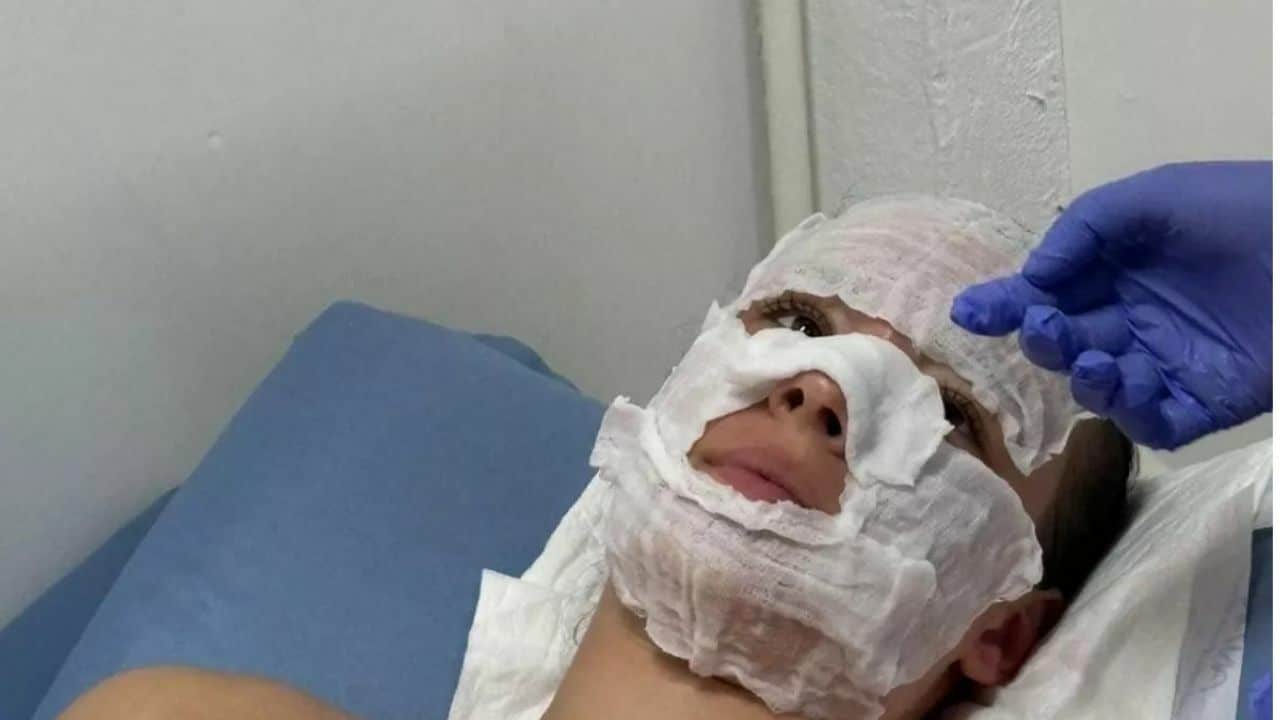 Thailand beach break ends in blistering agony for British teenager | News by Thaiger