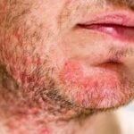 HIV and let die: Over half a million infected in Thailand outbreak | Thaiger